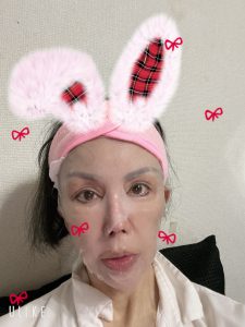 仮歯入りました　ハハハ【気まぐれ日記】